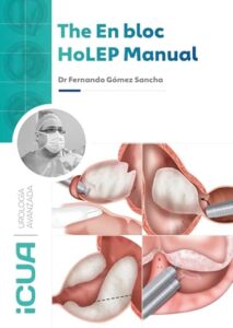 Portada del libro Manual de Enucleación en Bloque del Dr. Fernando Gómez Sancha